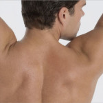 hair-removal-lead-image